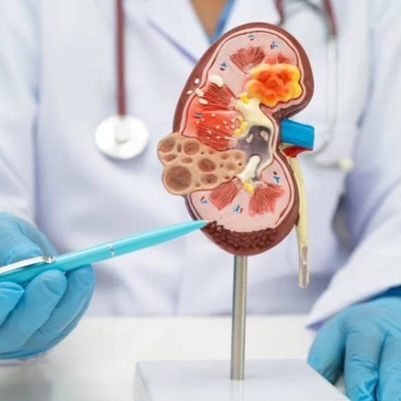 Un estudio alerta del avance de la enfermedad renal crónica entre las mujeres